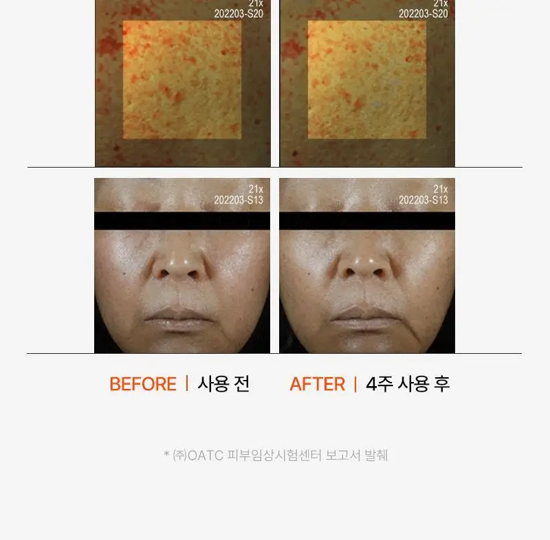 [대용량 속건조크림] 피캄 카토 크림 80ml 상세페이지 17